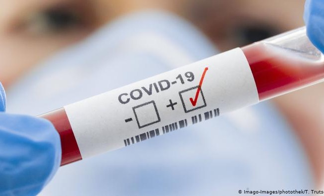 За сутки в России выявили 9 167 заразившихся коронавирусом