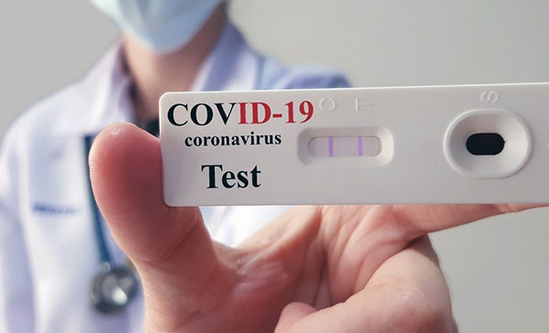 За последние сутки в регионе выявлено 112 новых случаев заражения COVID-19