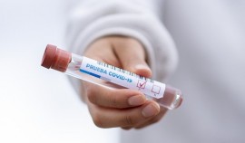 За прошедшие сутки в Чеченской Республике выявили 91 случай заражения COVID-19