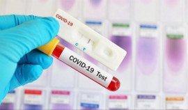За последние сутки в ЧР выявлено 113 случаев заражения коронавирусом