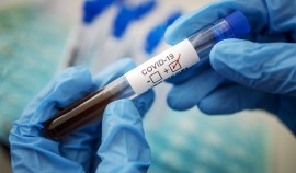 В ЧР выявлено 8 случаев заболевания COVID-19