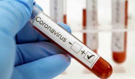 За сутки в Чеченской Республике выявили 123 случаев заражения коронавирусом