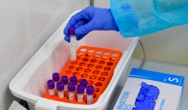 Российские медики провели более 100 млн тестов на COVID-19