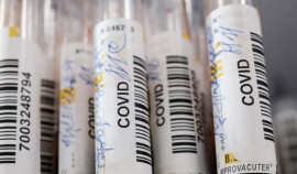 В России зарегистрировали тест на выявление иммунитета к COVID-19 у болевших бессимптомно