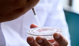 В России создан первый в мире быстрый тест для диагностики гепатита С