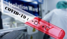 Под медицинским наблюдением из-за подозрения на COVID-19 остается около 568,7 тыс. человек