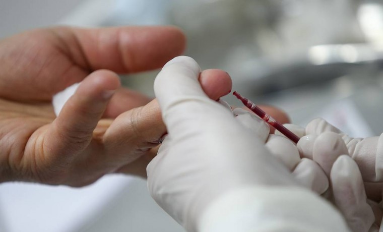 В РФ разработали новую тест-систему для определения антител к коронавирусу