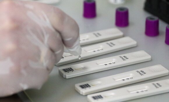 В России зарегистрирован экспресс-тест для привившихся от COVID-19
