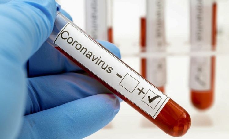 В Чеченской Республике за сутки выявили 12 случаев коронавируса