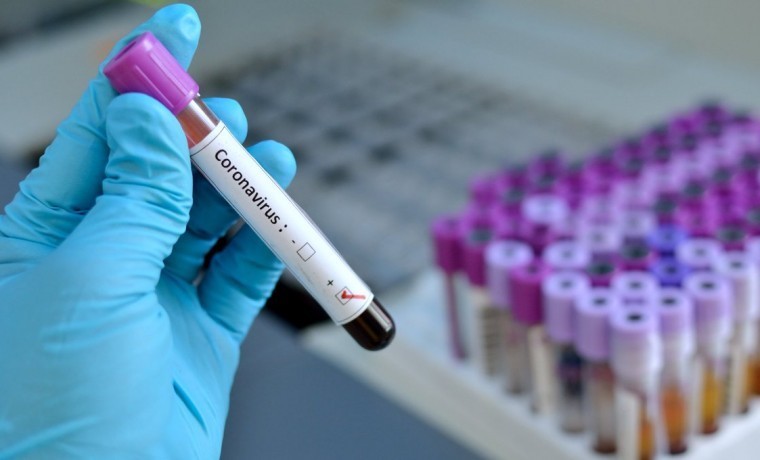 В ЧР на сегодняшний день первый компонент вакцины получили около 40% населения