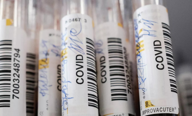 В России зарегистрировали тест на выявление иммунитета к COVID-19 у болевших бессимптомно
