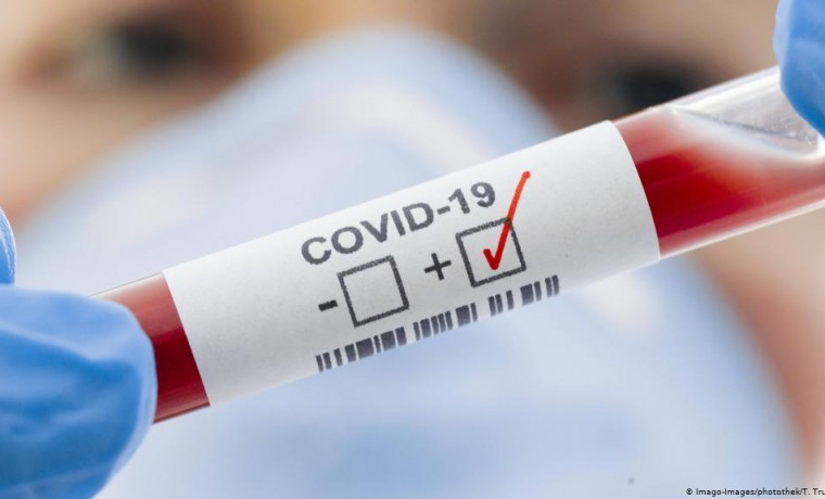 Названы регионы с наименьшими темпами прироста случаев COVID-19 за сутки