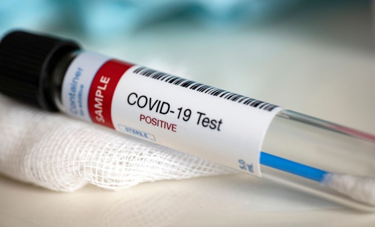 В ЧР за сутки выявлено 8 случаев COVID-19